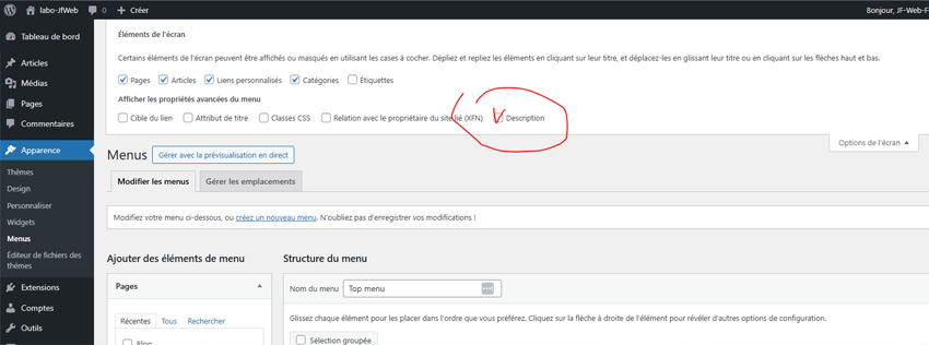 Options de l'écran et champ Description activé sur un item
