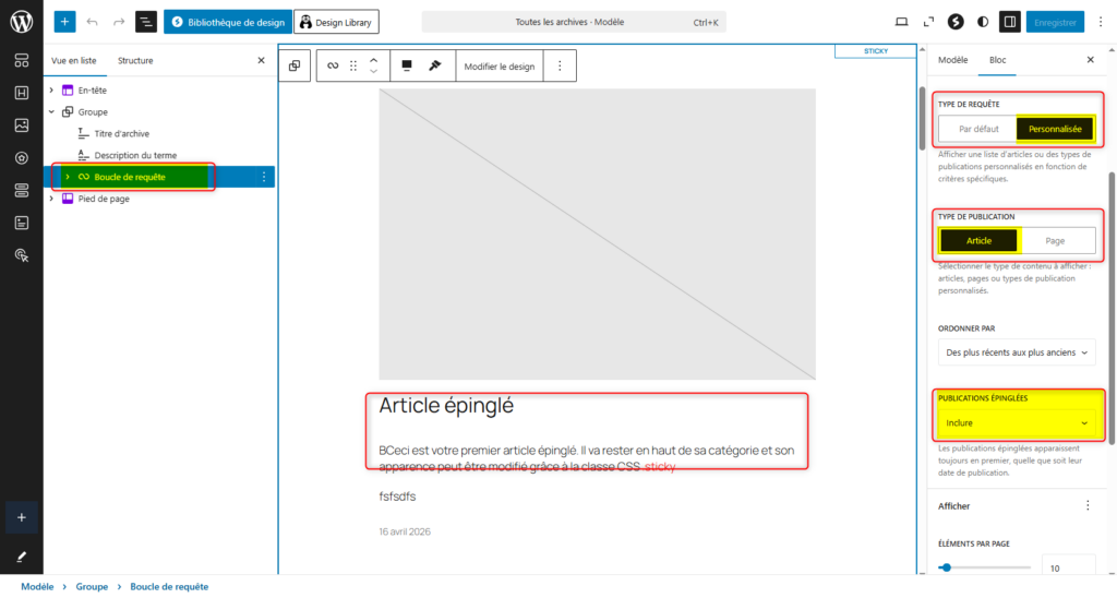 Configuration du bloc boucle de requête du modèle : toutes les archives